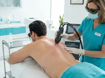 Back and chest laser hair removal for men at ProLaserSpa Paphos