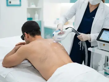 Man receiving laser hair removal on his back at ProLaserSpa Paphos