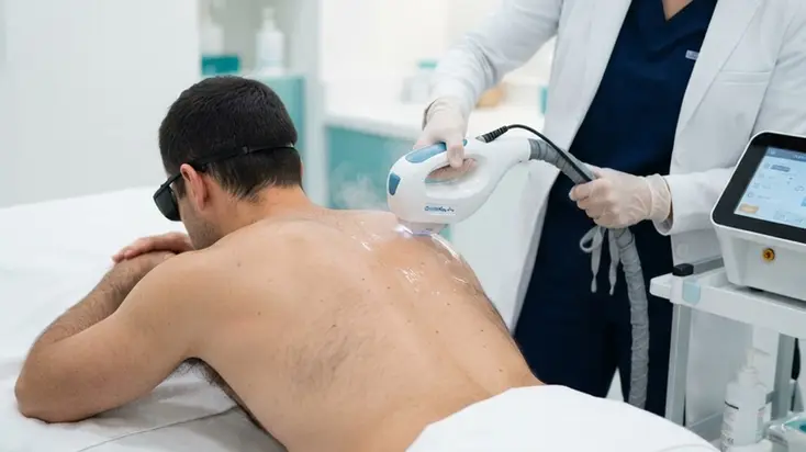 Man receiving laser hair removal on his back at ProLaserSpa Paphos