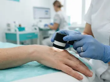 Pigmented lesion assessment at ProLaserSpa Paphos