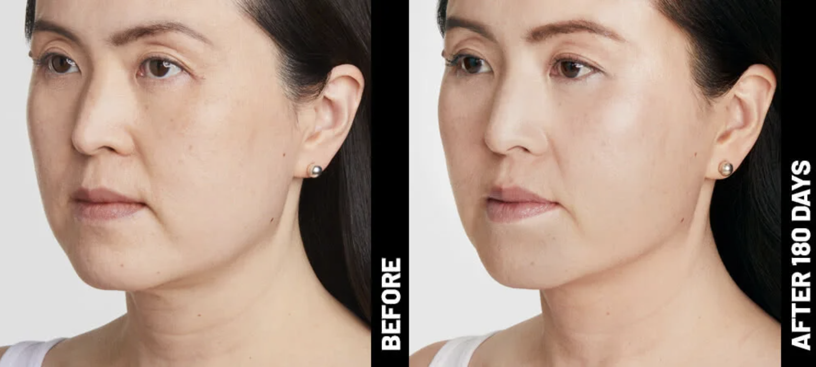 Face Before and After