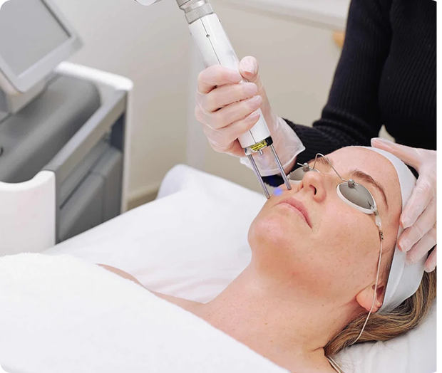 Dermission practitioner performing Pico-Genesis treatment