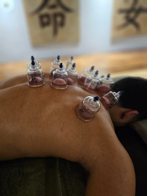 Cupping therapy targeting the shoulder blades and mid back