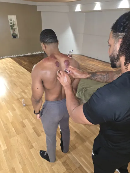 Securing a cupping device onto the upper back