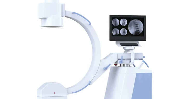 Wincom XRY-116C mobile digital C-arm system with C gantry and combined workstation monitor showing spinal fluoroscopy images