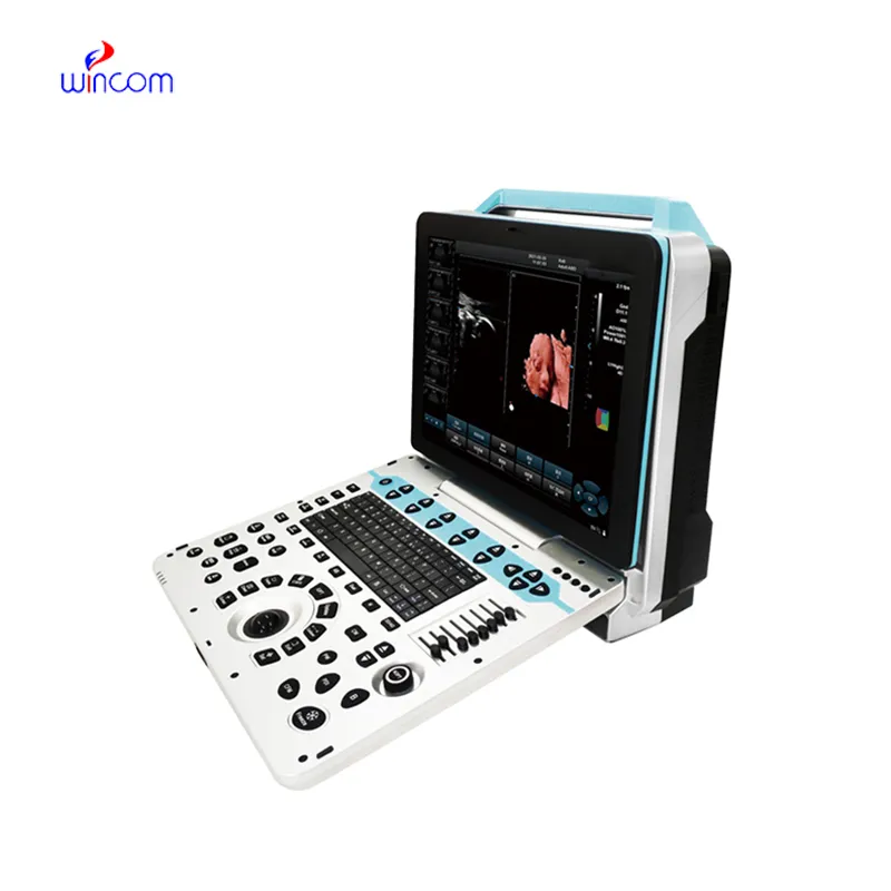 Portable 4D Color Doppler Ultrasound System USS-50-D