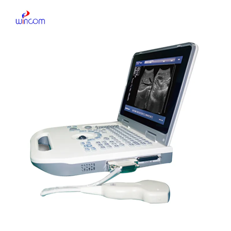 Full Digital Laptop Ultrasound Scanner USS-N50A
