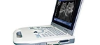 Full Digital Laptop Ultrasound Scanner USS-N50A — Wincom