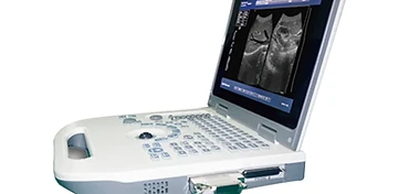 Wincom USS-N50A full digital laptop ultrasound scanner with trackball keyboard and convex probe