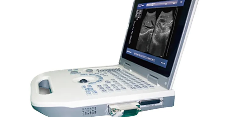 Full Digital Laptop Ultrasound Scanner USS-N50A — Wincom