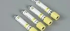 4ml Gel Activator Blood Collection Tube (SST) — REQUIRES VERIFICATION