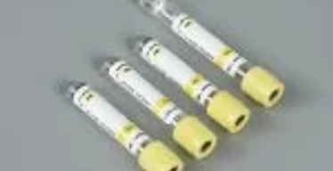 4ml Gel Activator Blood Collection Tube (SST) — REQUIRES VERIFICATION