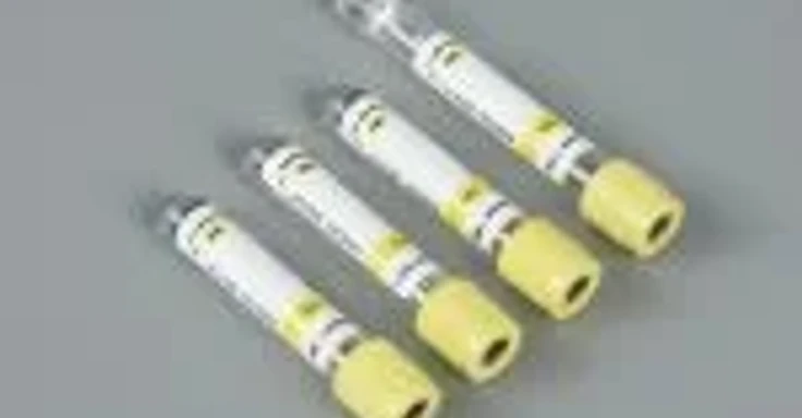 Yellow-capped 4ml gel activator serum separation blood collection tubes with printed sample-type labels