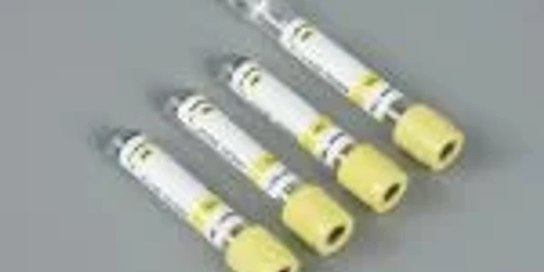 4ml Gel Activator Blood Collection Tube (SST) — REQUIRES VERIFICATION
