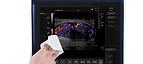 Pad Touch Vet Series Ultrasound System MSLVU45 — Medsinglong (view 2)