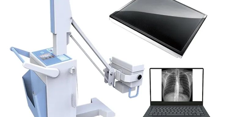 Wincom XRY-5100 mobile digital X-ray system with white trolley, articulating tube arm, 14-inch flat panel detector and workstation laptop showing chest radiograph