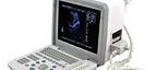 Full Digital LED Ultrasound Scanner USS-300 — Wincom
