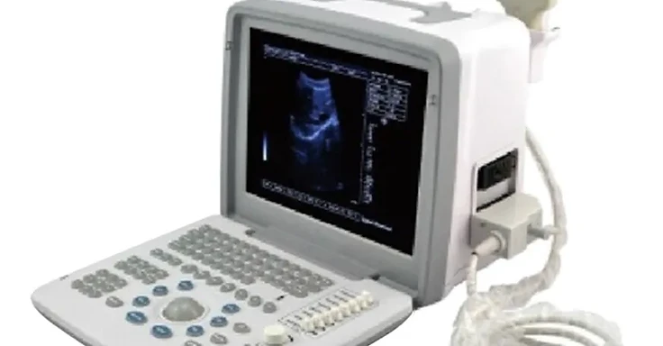 Wincom USS-300 full digital LED ultrasound scanner with 12.1-inch display, keyboard and convex probe