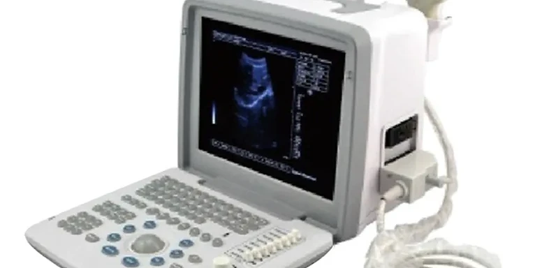 Full Digital LED Ultrasound Scanner USS-300 — Wincom