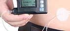 Portable Diabetes Insulin Infusion Pump MSLIS32 — Medsinglong (view 2)