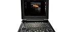Laptop Color Doppler Ultrasonic Diagnostic System USS-N20C — Wincom
