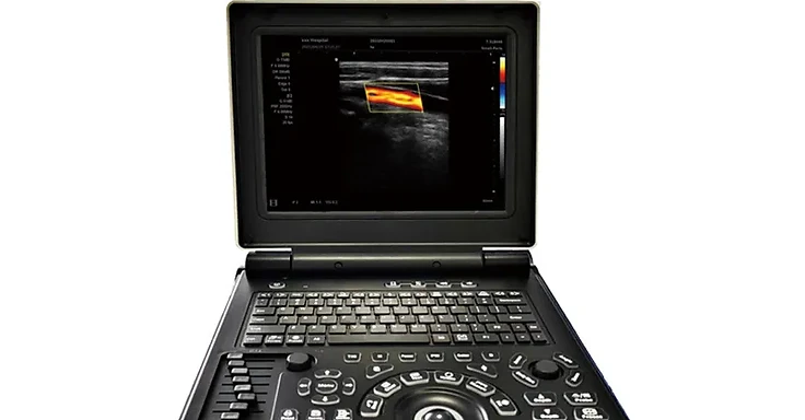 Wincom USS-N20C laptop color Doppler ultrasound system with keyboard, trackball and color flow imaging on screen