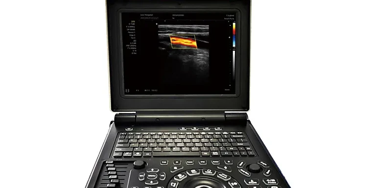 Laptop Color Doppler Ultrasonic Diagnostic System USS-N20C — Wincom