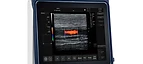 Pad Touch Vet Series Ultrasound System MSLVU45 — Medsinglong (view 1)