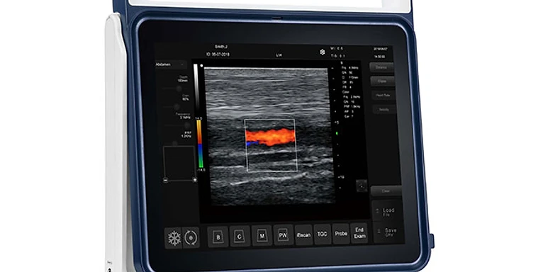 Pad Touch Vet Series Ultrasound System MSLVU45 — Medsinglong (view 1)