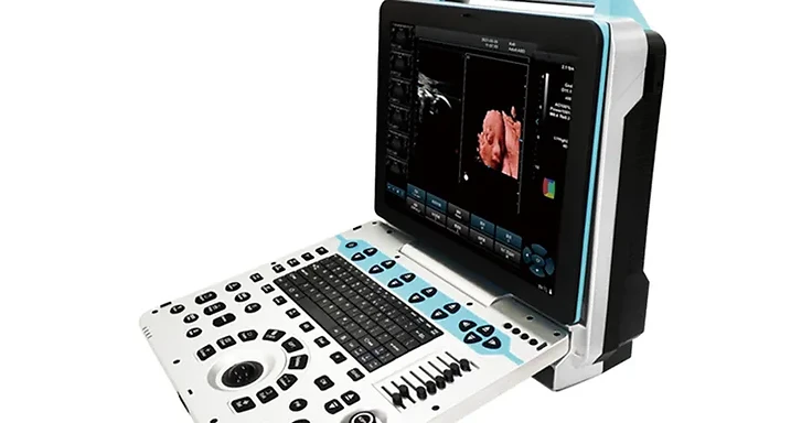 Wincom USS-5-D portable 4D color Doppler ultrasound system with keyboard, trackball and fetal sonogram on screen