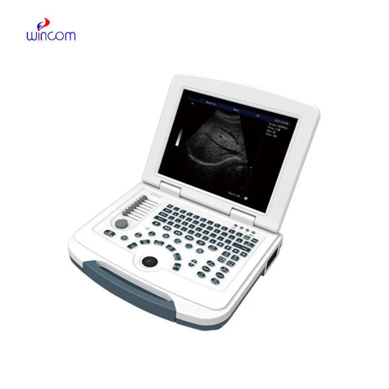 Notebook Digital Diagnostic Ultrasound System USS-N580