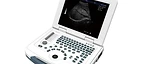 Notebook Digital Diagnostic Ultrasound System USS-N580 — Wincom
