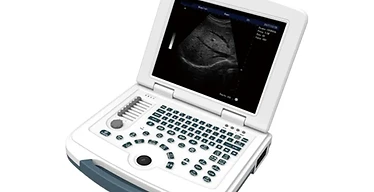Notebook Digital Diagnostic Ultrasound System USS-N580 — Wincom