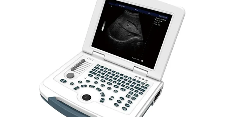 Wincom USS-N580 notebook digital diagnostic ultrasound system with 12.1-inch LCD and trackball console