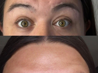 Anti-Wrinkle