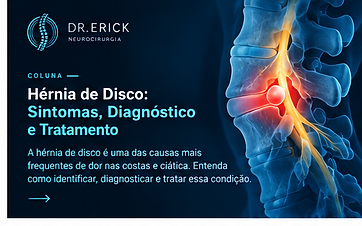 Hérnia de Disco: Sintomas, Diagnóstico e Tratamento