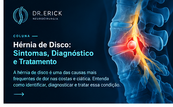 Hérnia de Disco: Sintomas, Diagnóstico e Tratamento