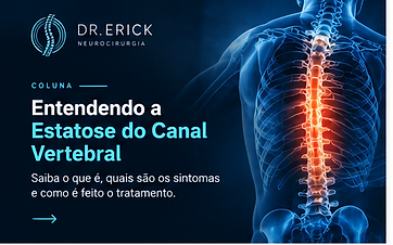 Estenose do Canal Vertebral: Entenda a Condição
