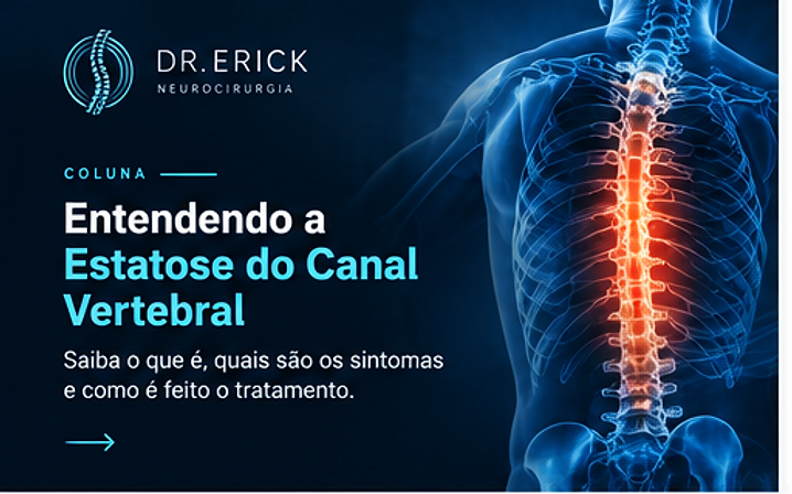 Estenose do Canal Vertebral: Entenda a Condição