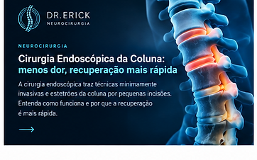 Cirurgia endoscópica da coluna: menos dor, recuperação mais rápida