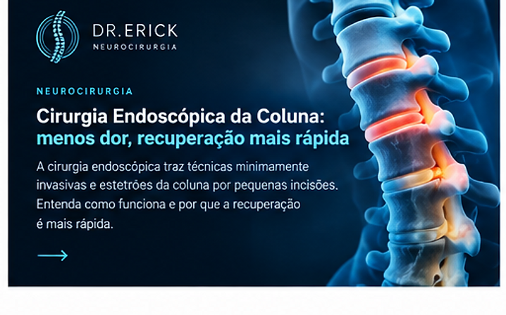 Cirurgia endoscópica da coluna: menos dor, recuperação mais rápida