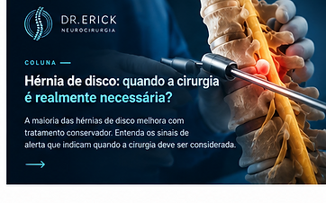 Hérnia de disco: quando a cirurgia é realmente necessária?