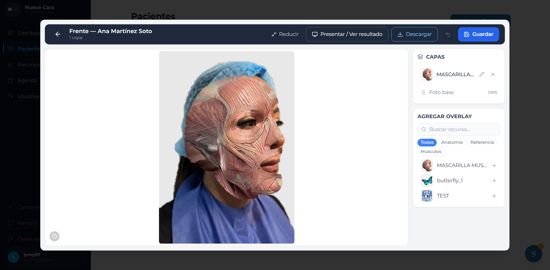 Editor visual tipo Canva del sistema médico, con capas y biblioteca de recursos overlay aplicados sobre la foto del paciente