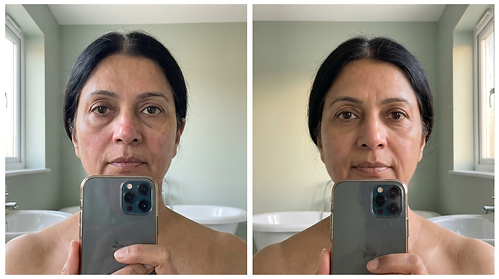 Priya N. — Under-eye & tone, week 0 and week 12
