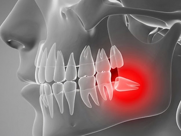 Cirurgia Oral
