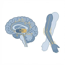 Parkinsonismo Medicamentoso