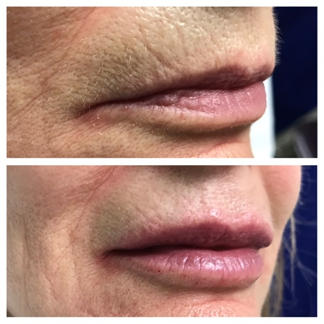 Before & After 14