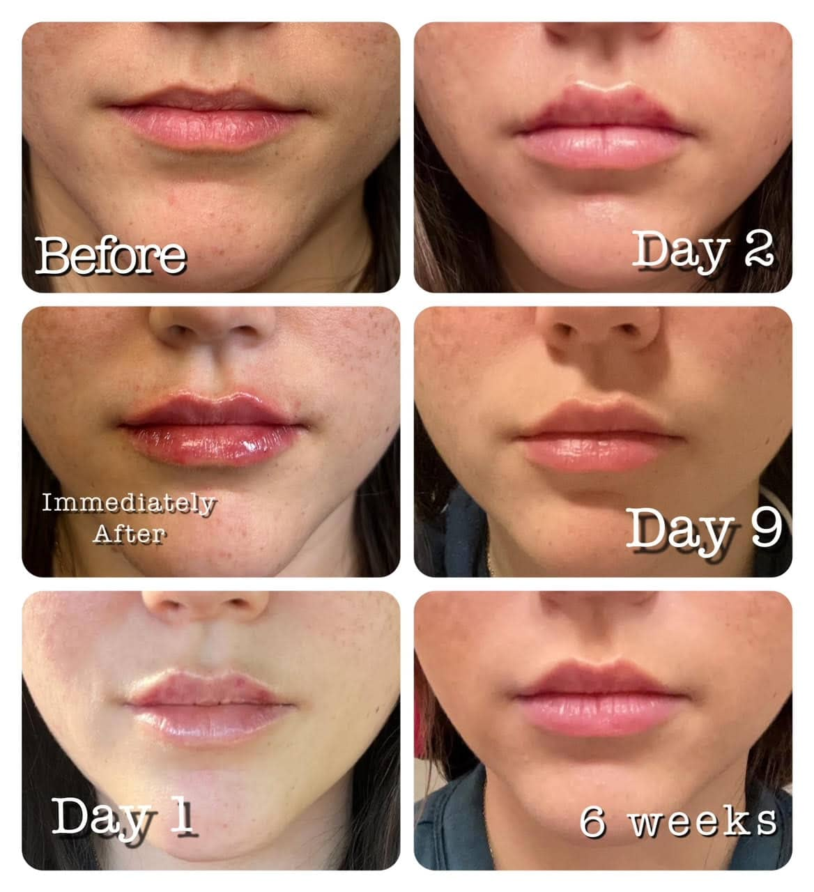 Before & After 2
