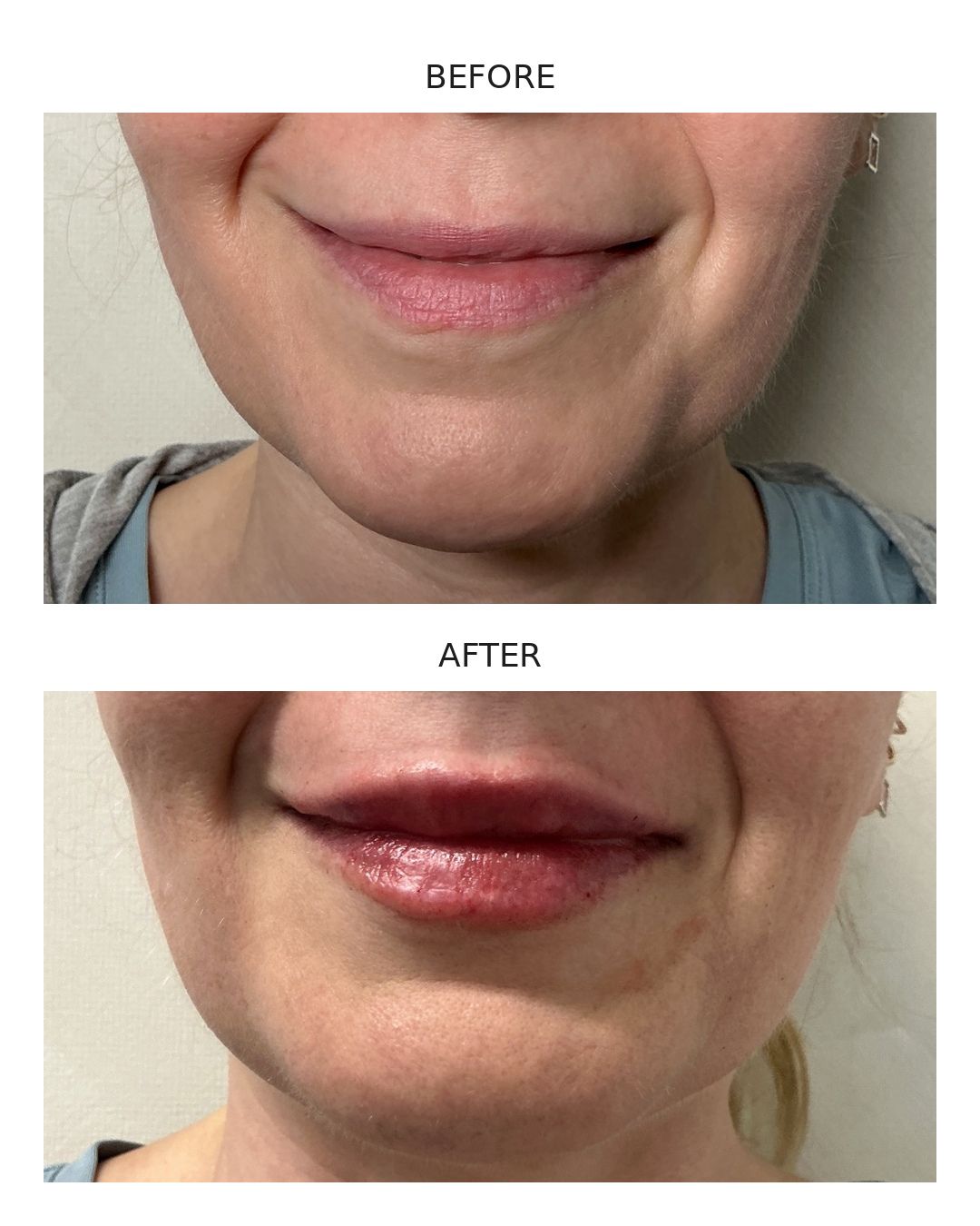 Before & After 7