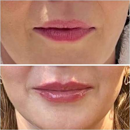 Before & After 3